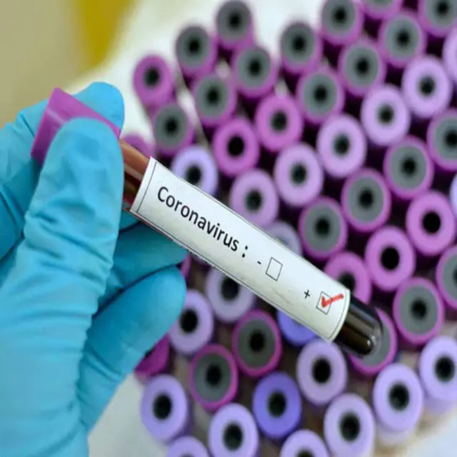 Different Stages of Coronavirus Outbreak and Popular Myths